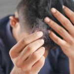 a man is combing his hair with his hands